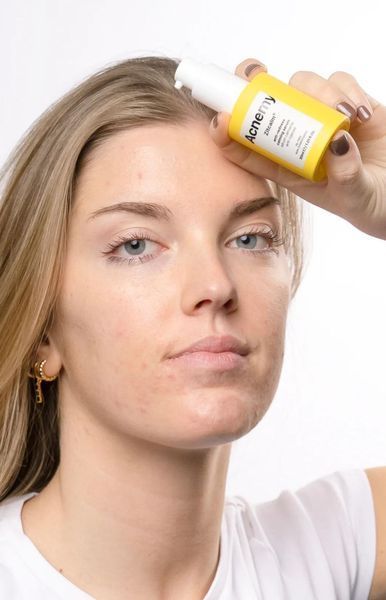 Заспокійлива Сироватка проти Почервонінь Acnemy Zitcalm Anti-Redness Calming Serum 30 мл 8436585436132 фото