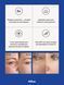 JOVS 4D Focus Laser Mask- Антивікова лазерна маска нового покоління jv0011 фото 2